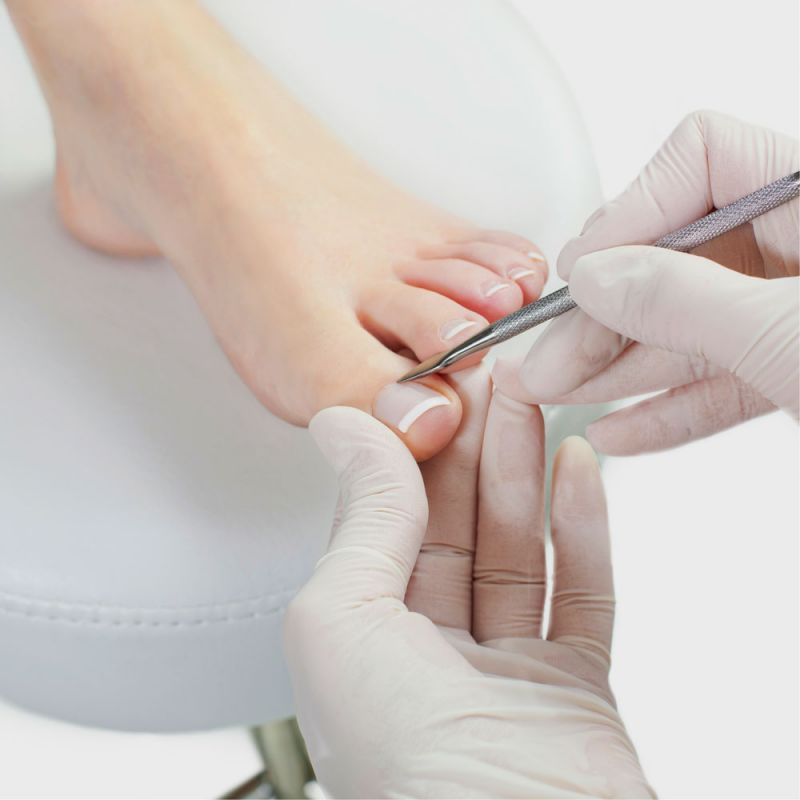 3to Nagelkorrektur Spange bei Studio Aveo Meran - Kosmetik Hautverbesserung und Beauty Behandlungen